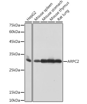 ARPC2 Rabbit Monoclonal Antibody