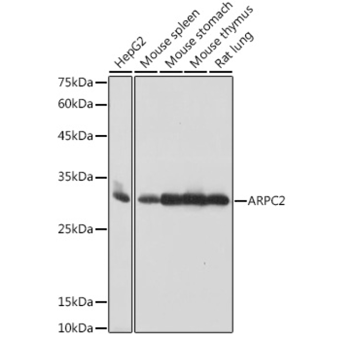 ARPC2 Rabbit Monoclonal Antibody