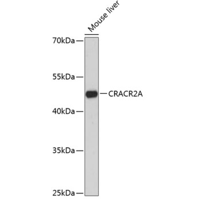 CRACR2A Rabbit Polyclonal Antibody