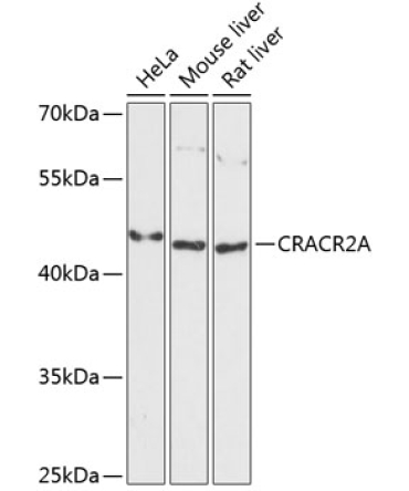 CRACR2A Rabbit Polyclonal Antibody