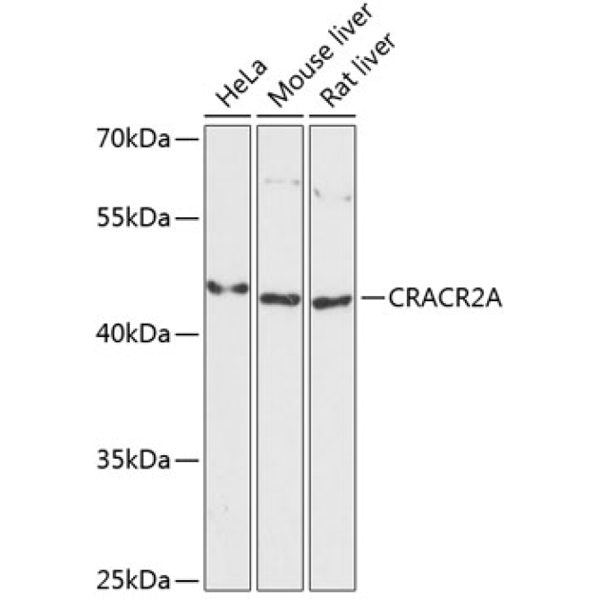 CRACR2A Rabbit Polyclonal Antibody