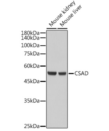 CSAD Rabbit Polyclonal Antibody