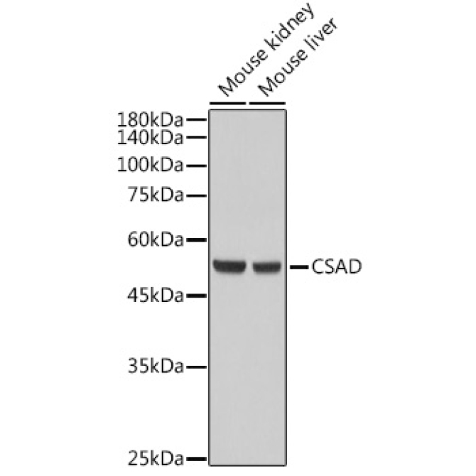 CSAD Rabbit Polyclonal Antibody