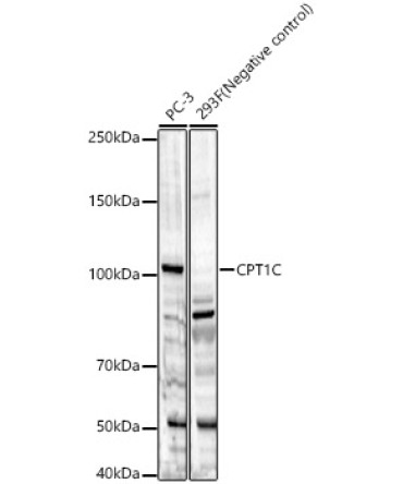 CPT1C Rabbit Polyclonal Antibody