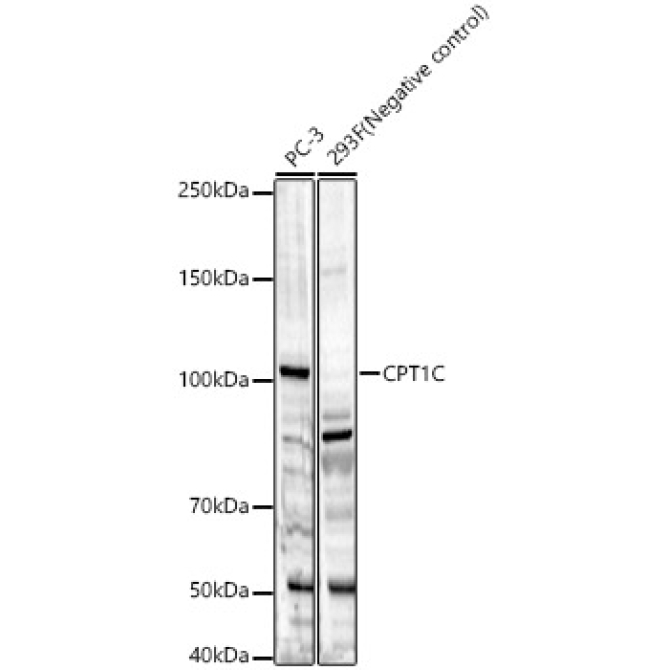 CPT1C Rabbit Polyclonal Antibody
