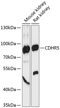 CDHR5 Rabbit Polyclonal Antibody