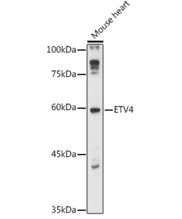 ETV4 Rabbit Polyclonal Antibody