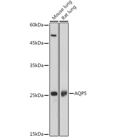 AQP5 Rabbit Polyclonal Antibody