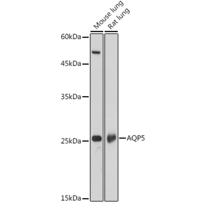 AQP5 Rabbit Polyclonal Antibody