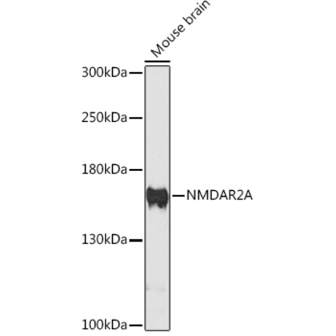 NMDAR2A Rabbit Polyclonal Antibody