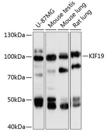 KIF19 Rabbit Polyclonal Antibody