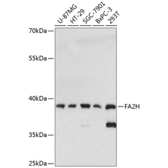 FA2H Rabbit Polyclonal Antibody
