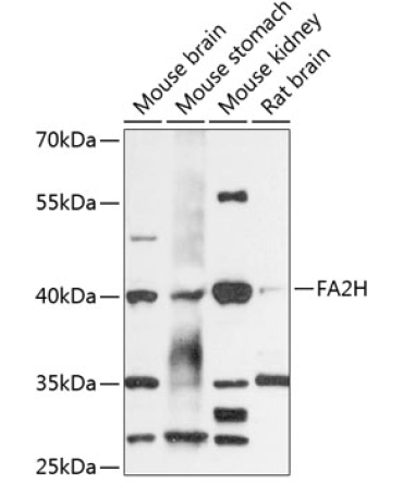 FA2H Rabbit Polyclonal Antibody