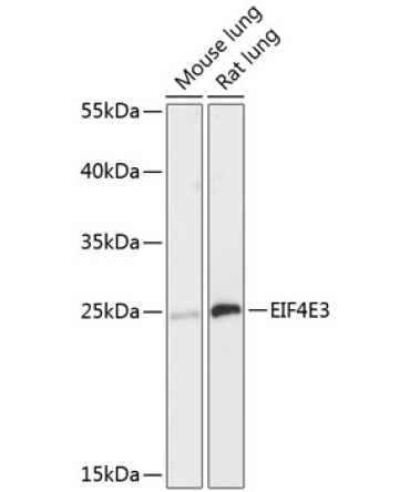 EIF4E3 Rabbit Polyclonal Antibody