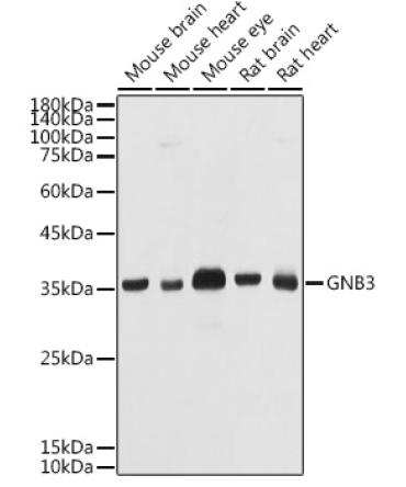 GNB3 Rabbit Polyclonal Antibody