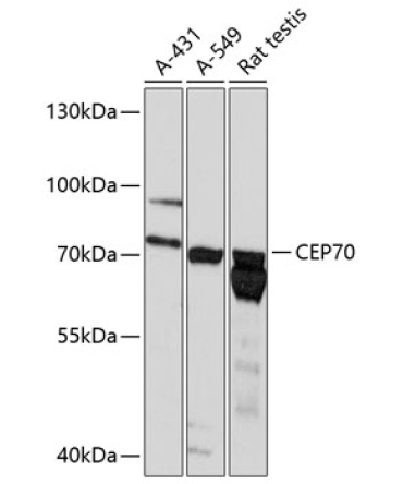CEP70 Rabbit Polyclonal Antibody