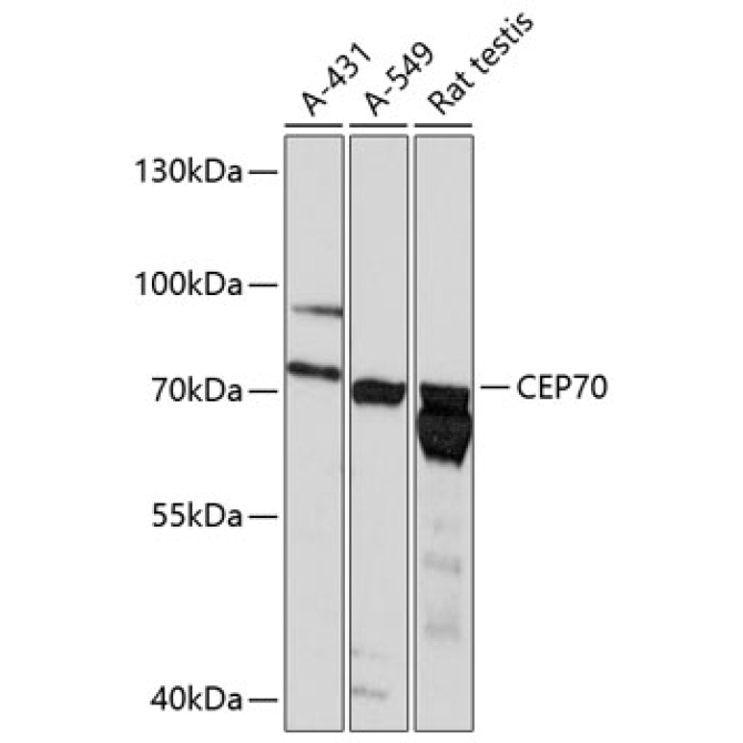 CEP70 Rabbit Polyclonal Antibody