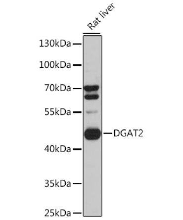 DGAT2 Rabbit Polyclonal Antibody