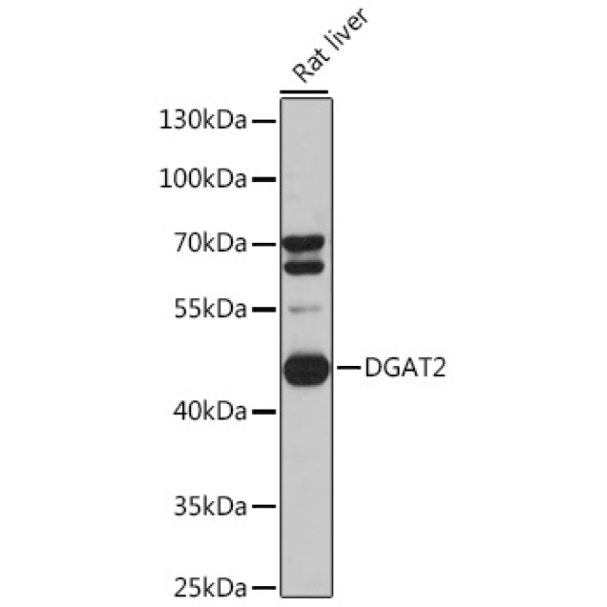 DGAT2 Rabbit Polyclonal Antibody