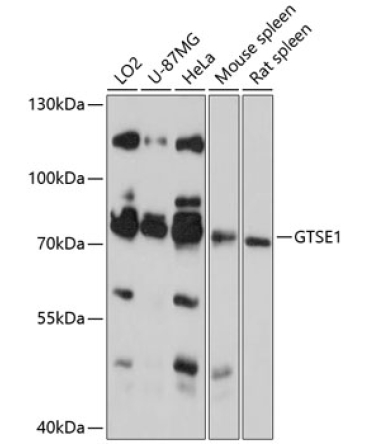GTSE1 Rabbit Polyclonal Antibody
