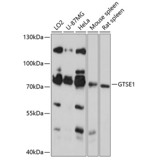 GTSE1 Rabbit Polyclonal Antibody