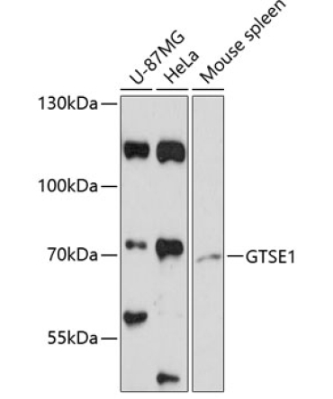 GTSE1 Rabbit Polyclonal Antibody