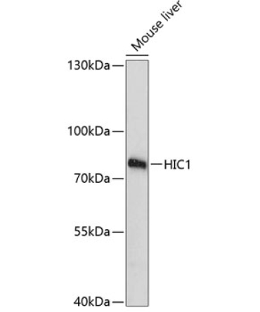 HIC1 Rabbit Polyclonal Antibody