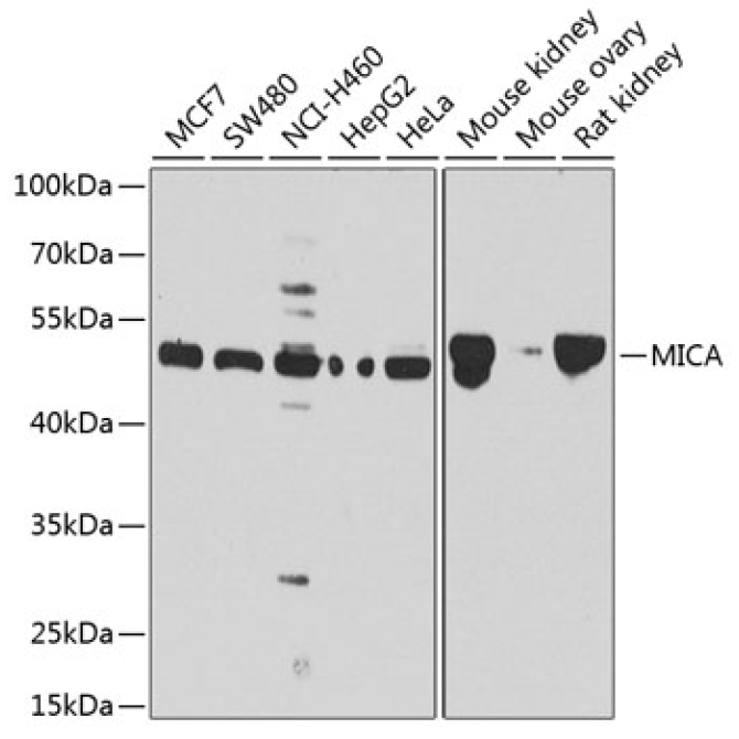 MICA Rabbit Polyclonal Antibody