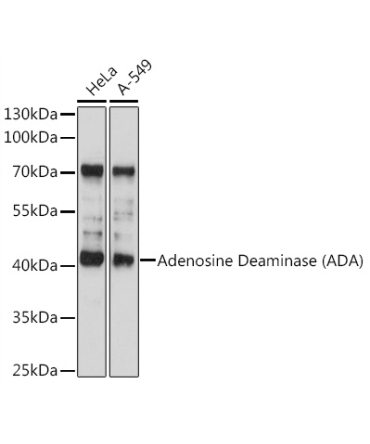 Adenosine Deaminase (ADA) Rabbit Polyclonal Antibody