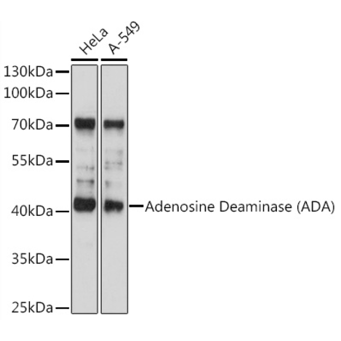 Adenosine Deaminase (ADA) Rabbit Polyclonal Antibody