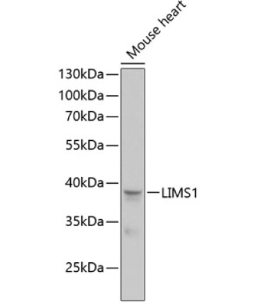 LIMS1 Rabbit Polyclonal Antibody
