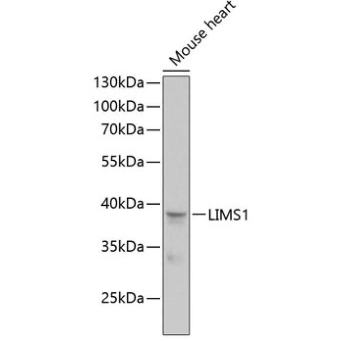 LIMS1 Rabbit Polyclonal Antibody