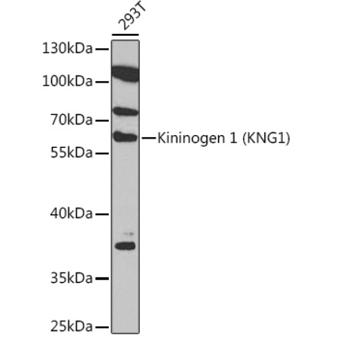 Kininogen 1 (KNG1) Rabbit Polyclonal Antibody