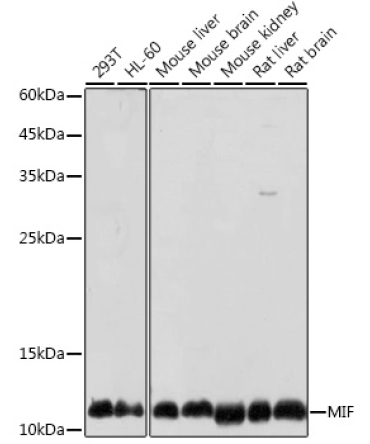 MIF Rabbit Polyclonal Antibody