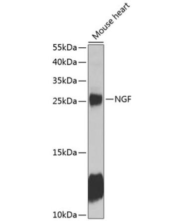 NGF Rabbit Polyclonal Antibody
