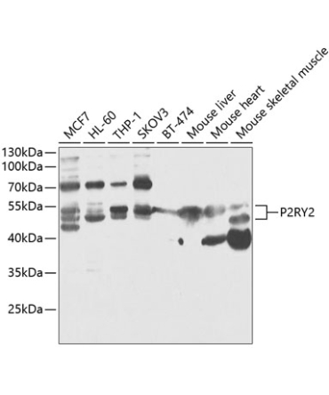 P2RY2 Rabbit Polyclonal Antibody