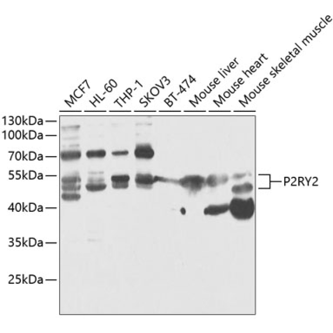 P2RY2 Rabbit Polyclonal Antibody