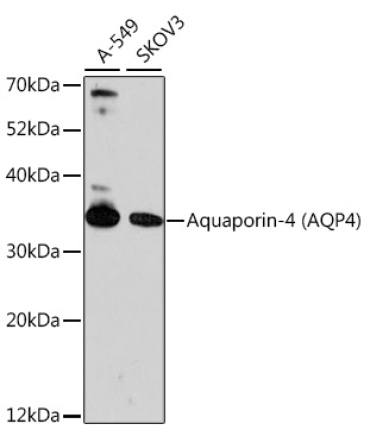 Aquaporin-4 (AQP4) Rabbit Polyclonal Antibody