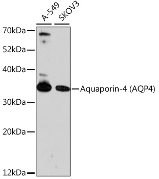 Aquaporin-4 (AQP4) Rabbit Polyclonal Antibody