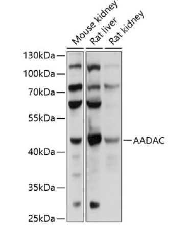 AADAC Rabbit Polyclonal Antibody