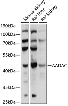 AADAC Rabbit Polyclonal Antibody