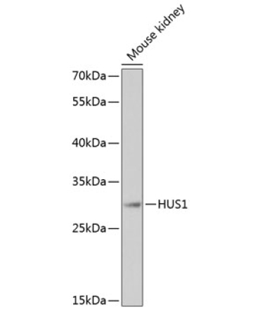 HUS1 Rabbit Polyclonal Antibody