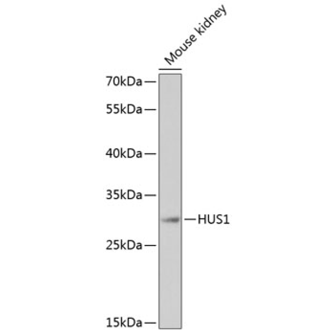 HUS1 Rabbit Polyclonal Antibody
