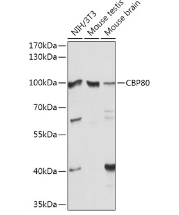 CBP80 Rabbit Polyclonal Antibody