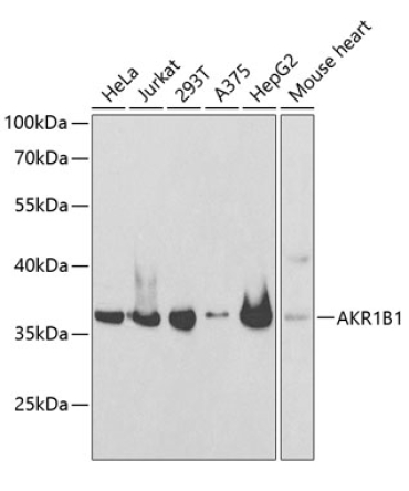 AKR1B1 Rabbit Polyclonal Antibody