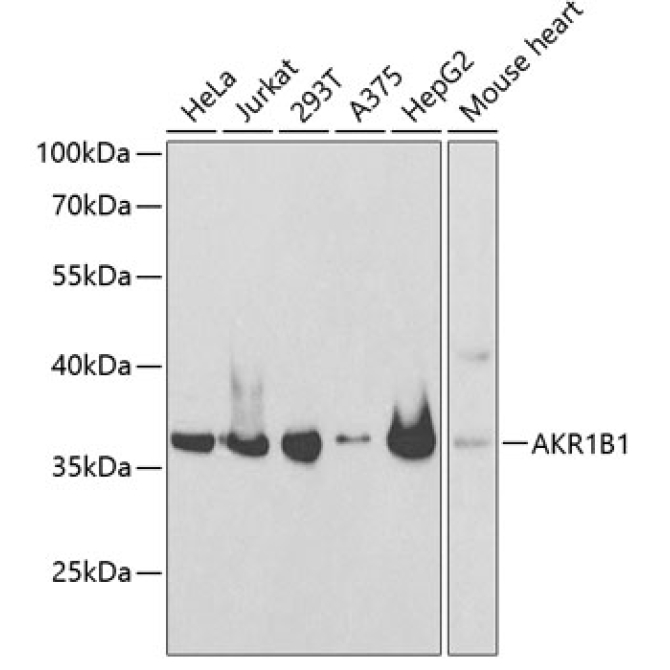 AKR1B1 Rabbit Polyclonal Antibody