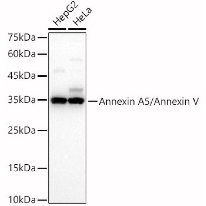 Annexin A5/Annexin V Rabbit Polyclonal Antibody
