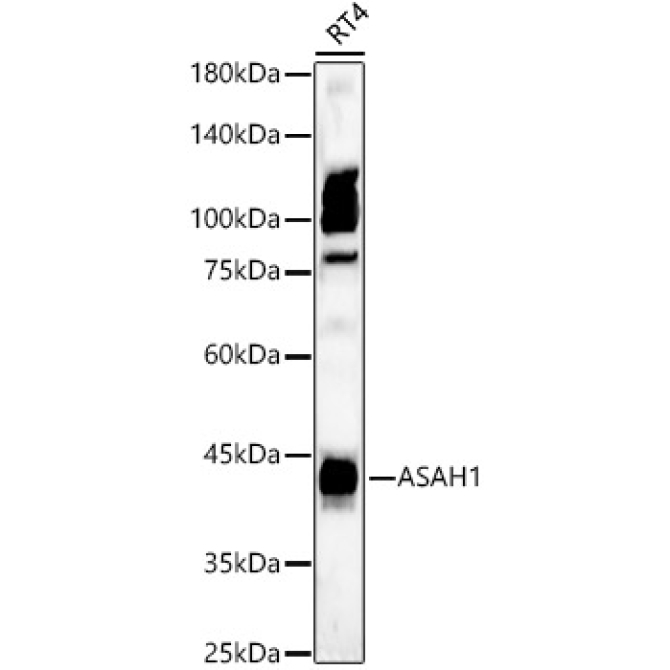 ASAH1 Rabbit Polyclonal Antibody