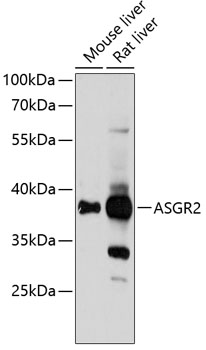 ASGR2 Rabbit Polyclonal Antibody
