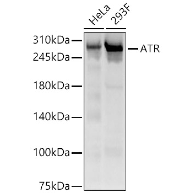 ATR Rabbit Polyclonal Antibody